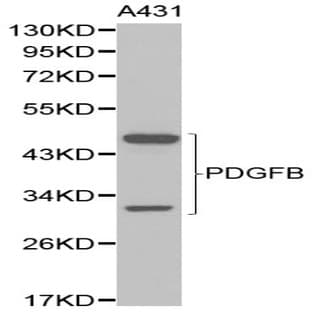PDGFB pAb