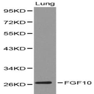FGF10 pAb avatar