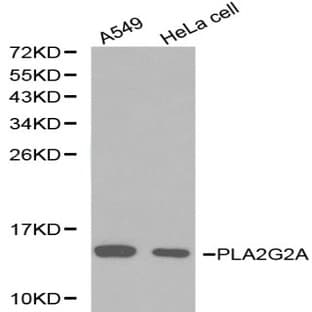 PLA2G2A pAb avatar
