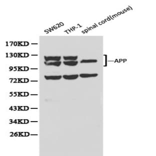 APP/(beta)-Amyloid pAb avatar