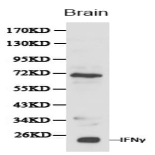 IFN-(gamma) pAb avatar