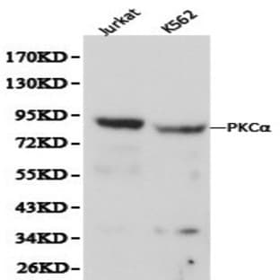 PKC (alpha) pAb avatar