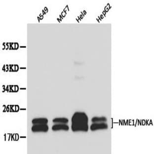 NM23-H1 (NDKA) pAb avatar
