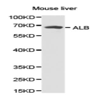 Albumin pAb avatar