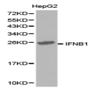 IFNB1 pAb avatar