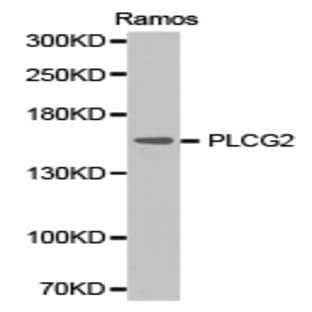 PLC (gamma)2 pAb avatar
