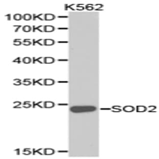 SOD2 pAb avatar