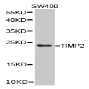 TIMP2 pAb avatar