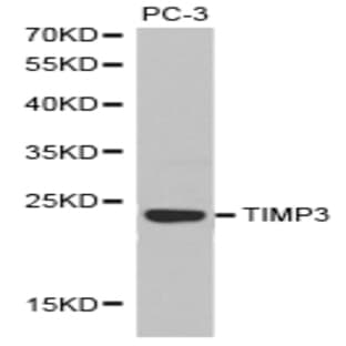 TIMP3 pAb avatar