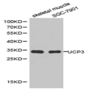 UCP3 pAb