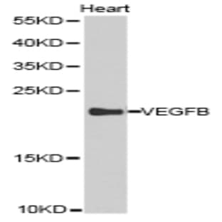 VEGFB pAb avatar