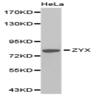 ZYX pAb avatar