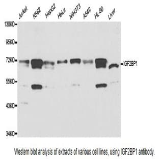 IGF2BP1 pAb avatar