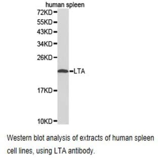 TNF-(beta) / LTA pAb avatar
