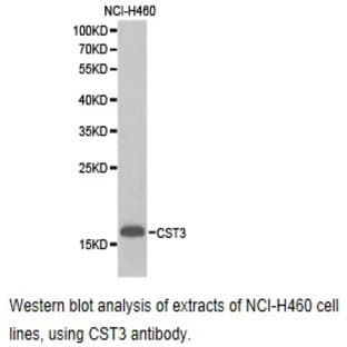 Cystatin C / CST3 pAb avatar