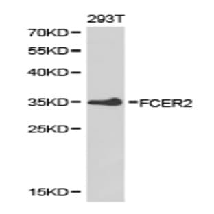 FCER2 pAb avatar