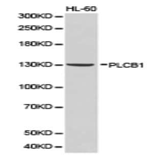 PLCB1 pAb avatar