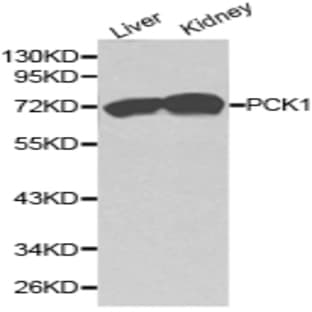 PCK1 pAb avatar