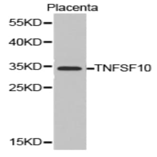 TRAIL/ TNFSF10 pAb avatar