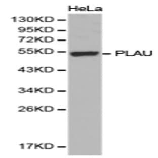 uPA / PLAU pAb avatar