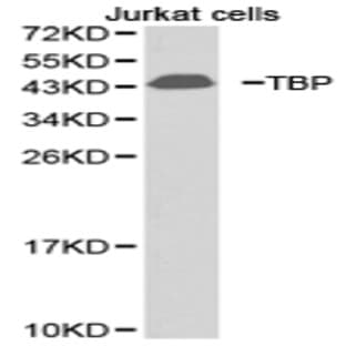 TBP pAb avatar