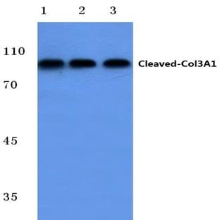 Cleaved-Collagen 3A1 (G1221) pAb avatar