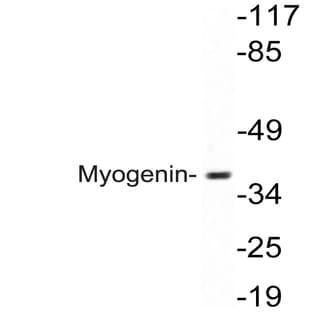 Myogenin (E99) pAb avatar
