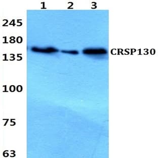 CRSP130 (F26) pAb avatar