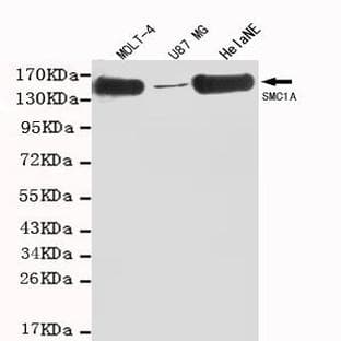 SMC1A (C-terminus) mAb avatar