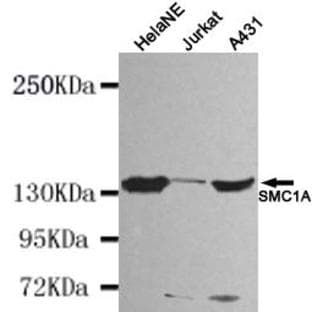 SMC1A (N-terminus) mAb avatar
