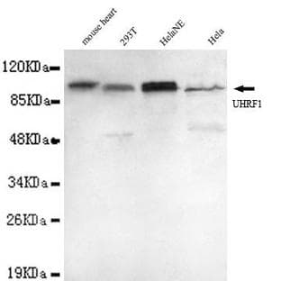 UHRF1 (N-terminus) mAb avatar