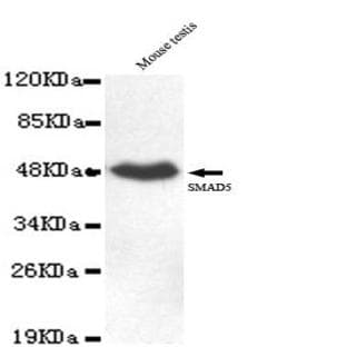 Smad5 (C-terminus) mAb avatar