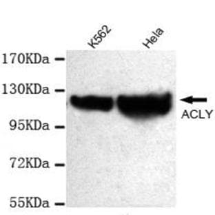 ATP-Citrate Lyase (C-terminus) mAb avatar