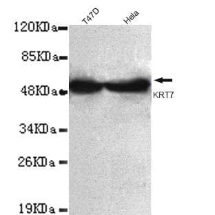 Cytokeratin 7 (C-terminus) mAb avatar