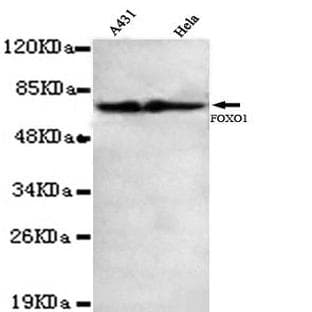 FKHR / FoxO1 (C-terminus) mAb