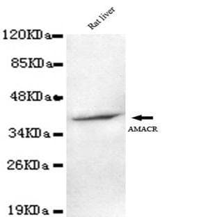 AMACR (C-terminus) mAb avatar