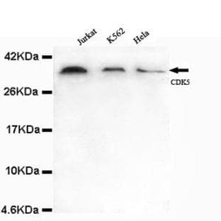 CDK5 (N-terminus) mAb avatar