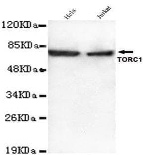 TORC1 (N-terminus) mAb avatar