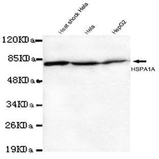 HSP70 (N-terminus) mAb avatar