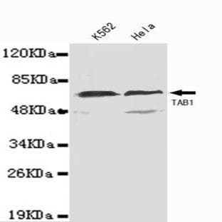 TAB1(N-terminus) mAb avatar