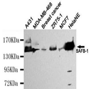 SAFB-1 mAb avatar