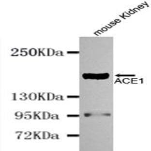ACE (N-terminus) mAb avatar