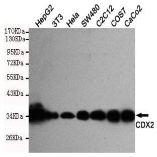 CDX2 mAb avatar
