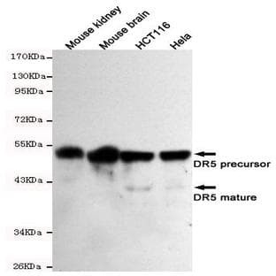 TNFRSF10B / DR5 mAb avatar