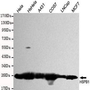 HSP27 mAb avatar