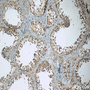 TEKT3 Antibody - tektin 3