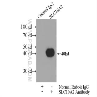 ASBT Antibody - solute carrier family 10 (sodium/bile acid cotransporter family), member 2 avatar