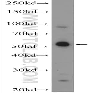 MANEA Antibody - mannosidase, endo-alpha