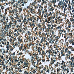 PVRIG Antibody - poliovirus receptor related immunoglobulin domain containing