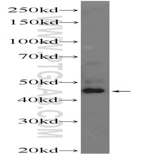ZDHHC15 Antibody - zinc finger, DHHC-type containing 15